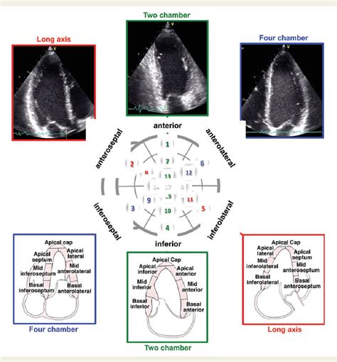 accendink lv|Recommendations for Cardiac Chamber Quantification by Echocardiography .